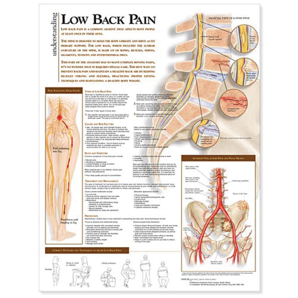 Understanding Low Back Pain Anatomical Chart Chirosupply